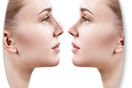 Revision Nose Aesthetics (Revision Rhinoplasty)