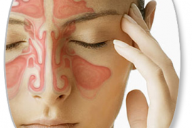 Endoscopic Sinus Surgery