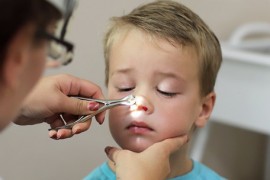 Adenoid Surgery